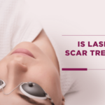 Is-Laser-Acne-Scar-Treatment-Safe-1-1024x538.png